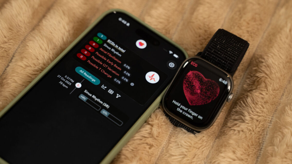 Apple Watch Series 11 Review